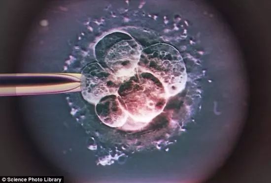 女子车祸后10天供卵试管婴儿流产供卵试管婴儿胚胎移植后应注意什么？