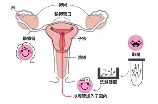 做供卵试管婴儿生男孩比生女孩的可能性大吗？