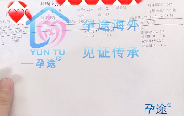 男方应该为上海供卵试管婴儿做哪些准备？