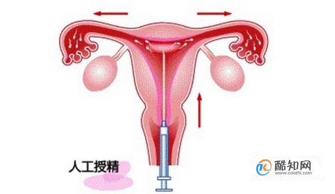 2022年三代供卵试管婴儿的费用是多少？