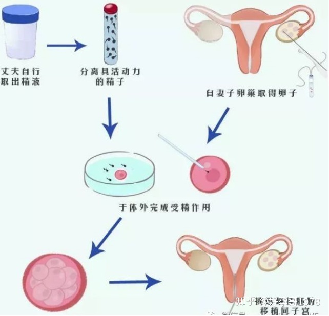 浙江省第一医院的供卵试管公立不用等育儿医生有哪些,如何选择