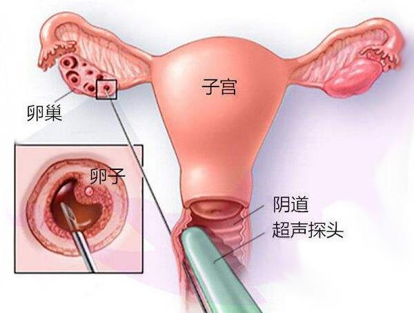 想知道哪个54岁有药流史的女性哪里试管代怀成功率高成功怀孕了